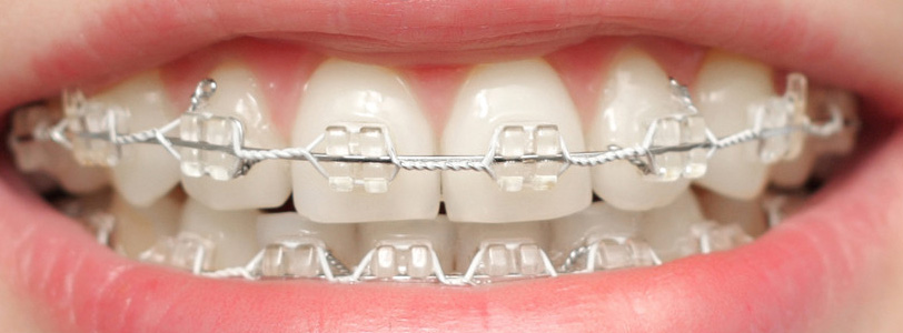Ankara Ortodonti Doktorlar