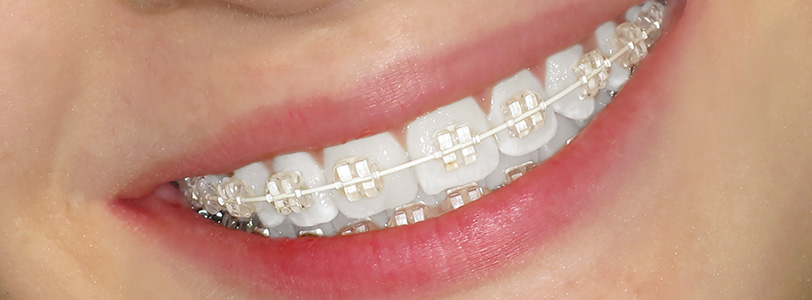Ortodonti Uzmanı Kimdir