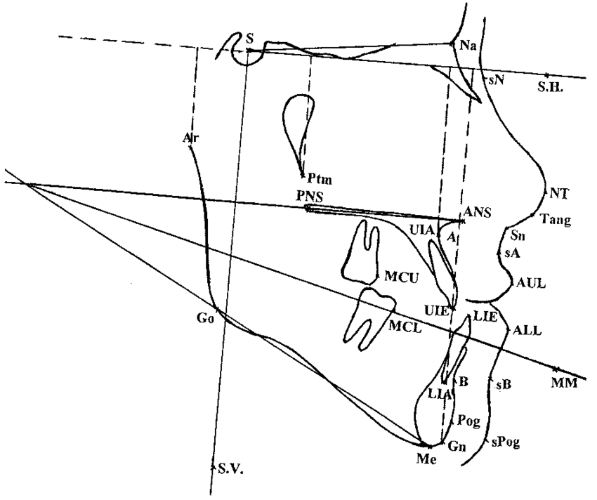 Lateral Sefalometrik Film